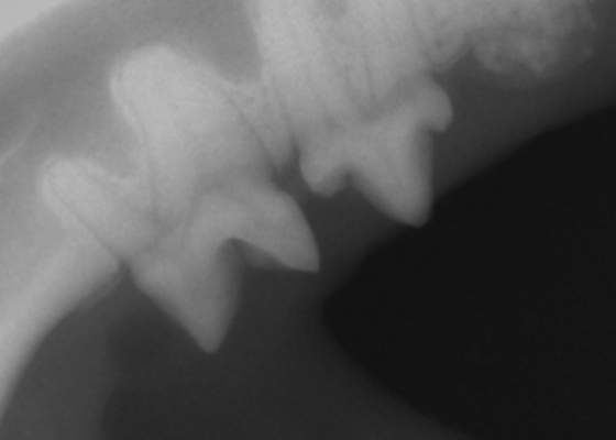 歯科用デジタルレントゲン撮影