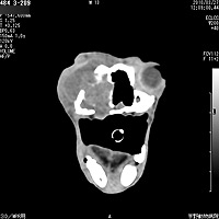 鼻腔内腫瘍のCT画像1