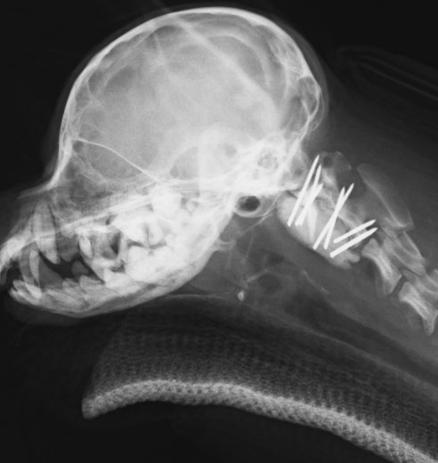 環軸椎亜脱臼の犬にピンによる固定を実施した例3