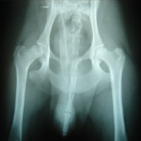 レッグペルテス（大腿骨頭壊死症(レッグペルテス) のCT像）3