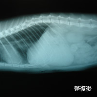 横隔膜ヘルニア（横隔膜ヘルニアの術前・術後X線像）3