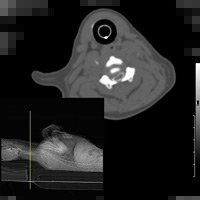 脊髄造影（頸部椎間板ヘルニア(ビーグル)の脊髄造影CT像）1